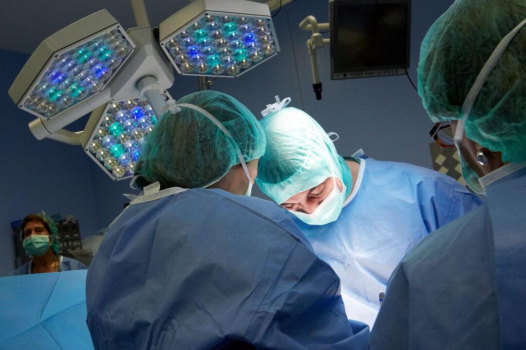 Operación en prostatitis crónica