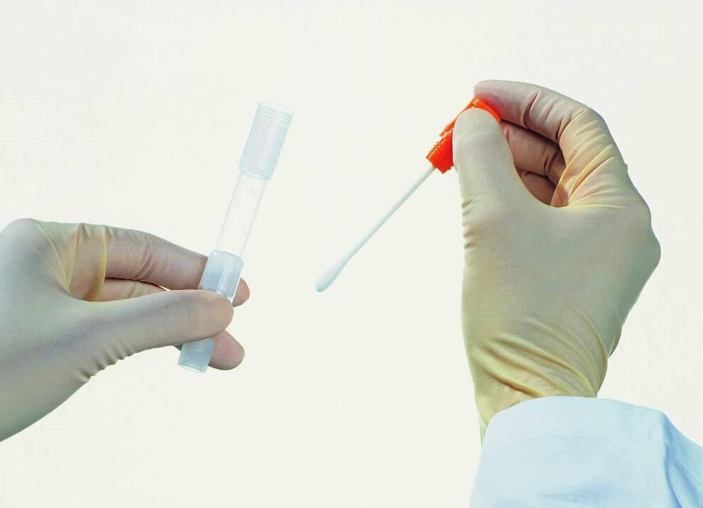 Recolección de análisis para detectar prostatitis crónica