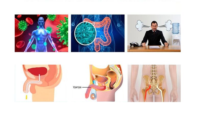 causas de la prostatitis